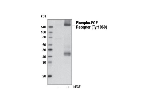 Western Blotting Image 1: Phospho-EGF Receptor (Tyr1068) (D7A5) XP® Rabbit mAb (Biotinylated)