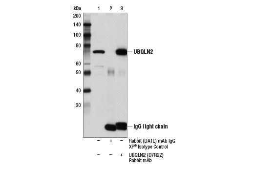 Immunoprecipitation Image 1: UBQLN2 (D7R2Z) Rabbit mAb