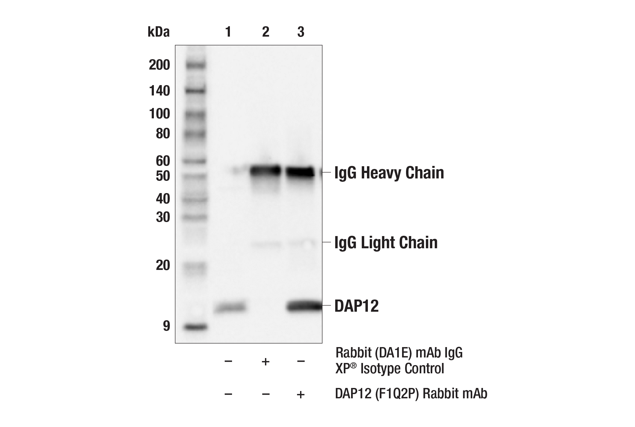 Immunoprecipitation Image 2: DAP12 (F1Q2P) Rabbit mAb