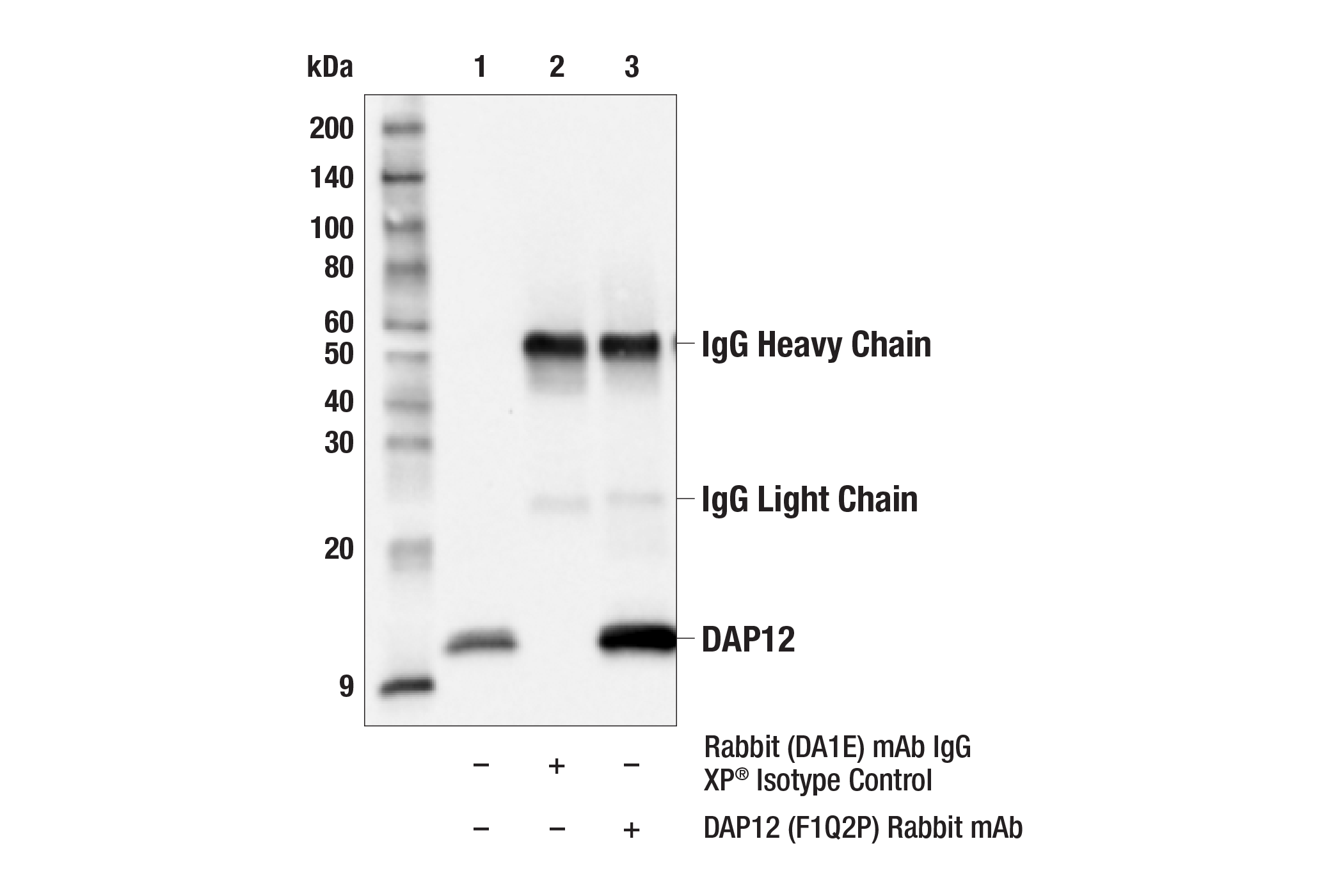 Immunoprecipitation Image 1: DAP12 (F1Q2P) Rabbit mAb