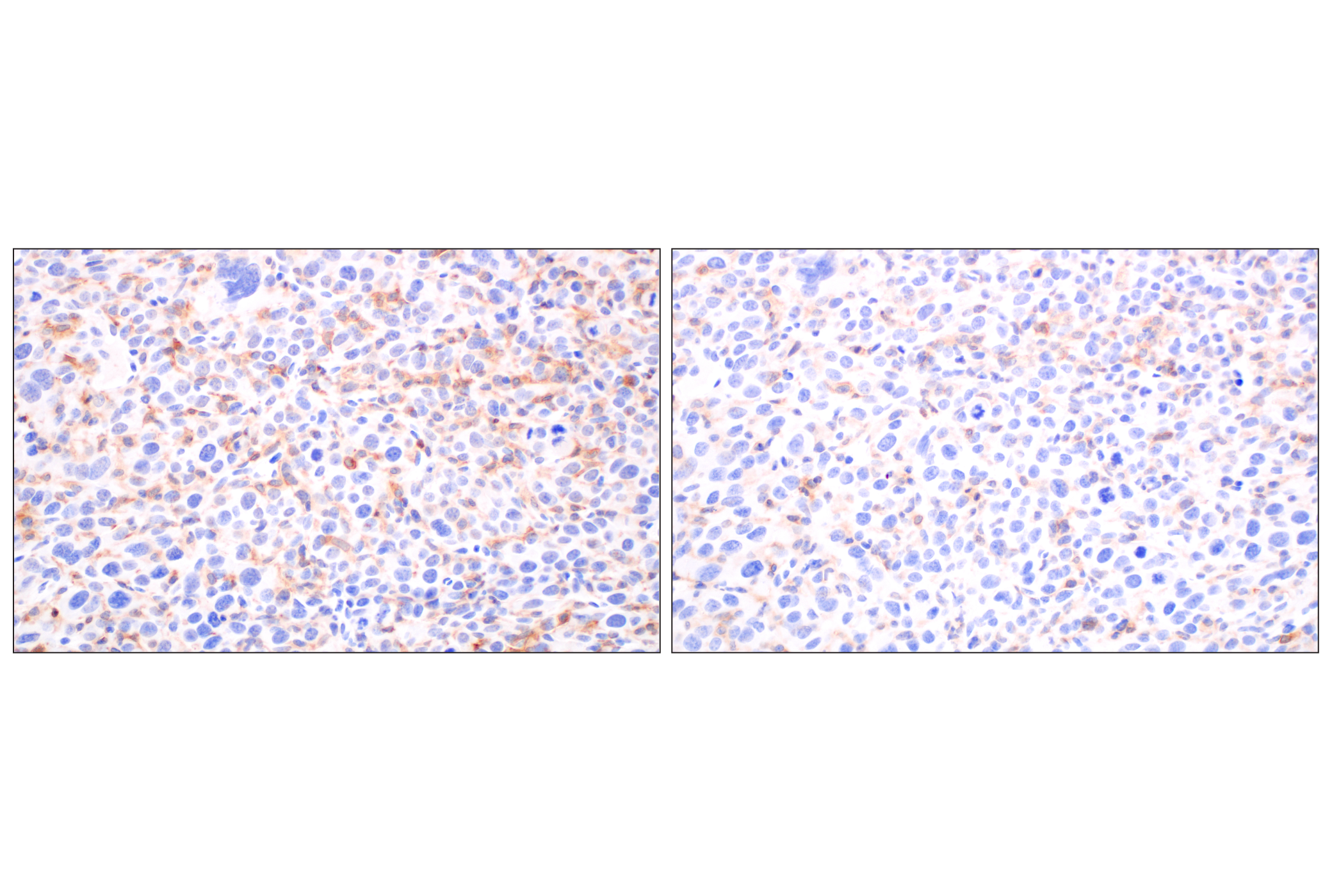 Immunohistochemistry Image 8: DAP12 (F1Q2P) Rabbit mAb