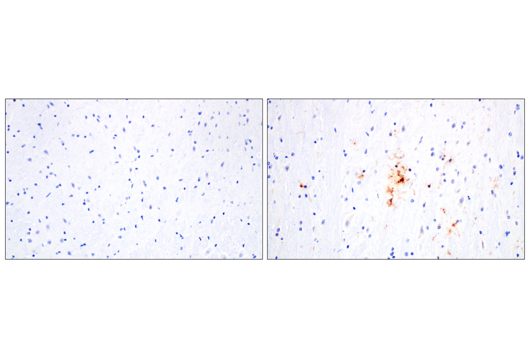 Immunohistochemistry Image 3: DAP12 (F1Q2P) Rabbit mAb
