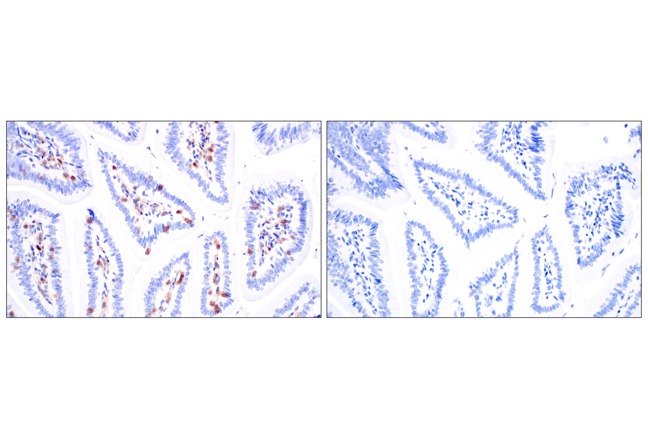Immunohistochemistry Image 9: DAP12 (F1Q2P) Rabbit mAb