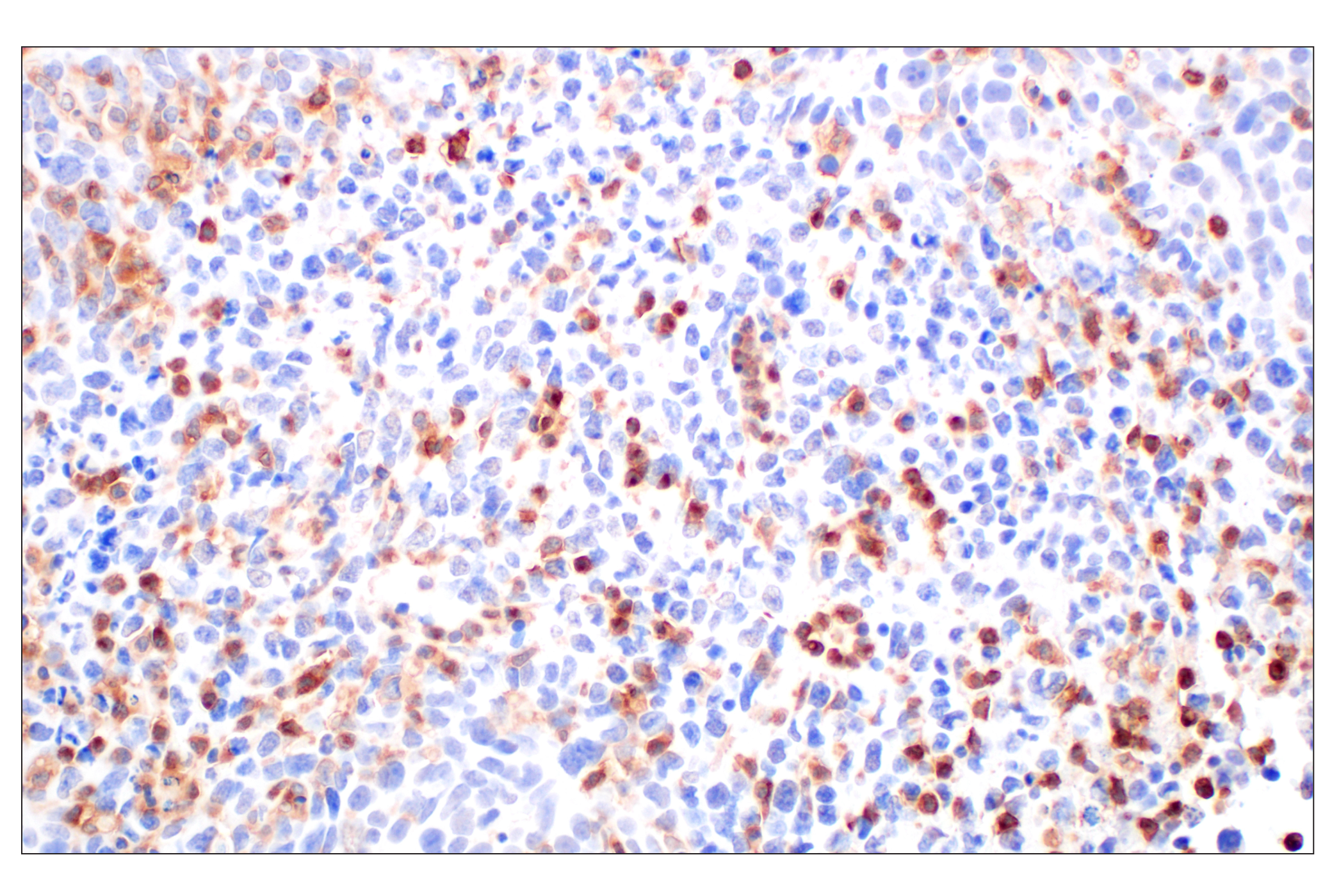 Immunohistochemistry Image 2: DAP12 (F1Q2P) Rabbit mAb