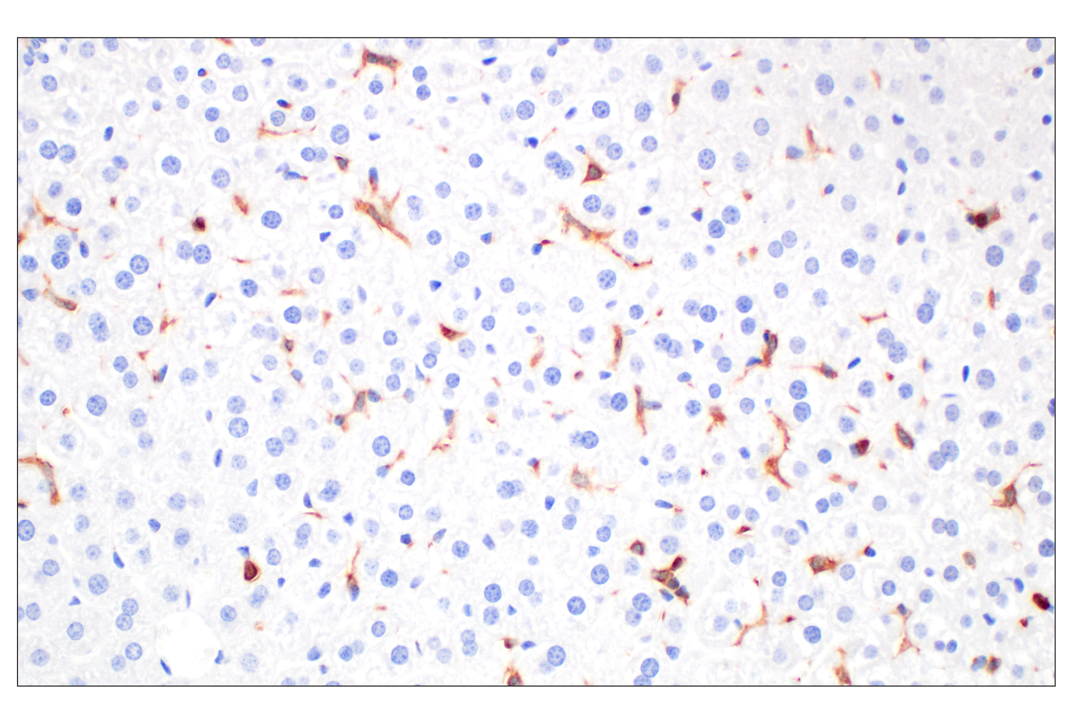 Immunohistochemistry Image 7: DAP12 (F1Q2P) Rabbit mAb