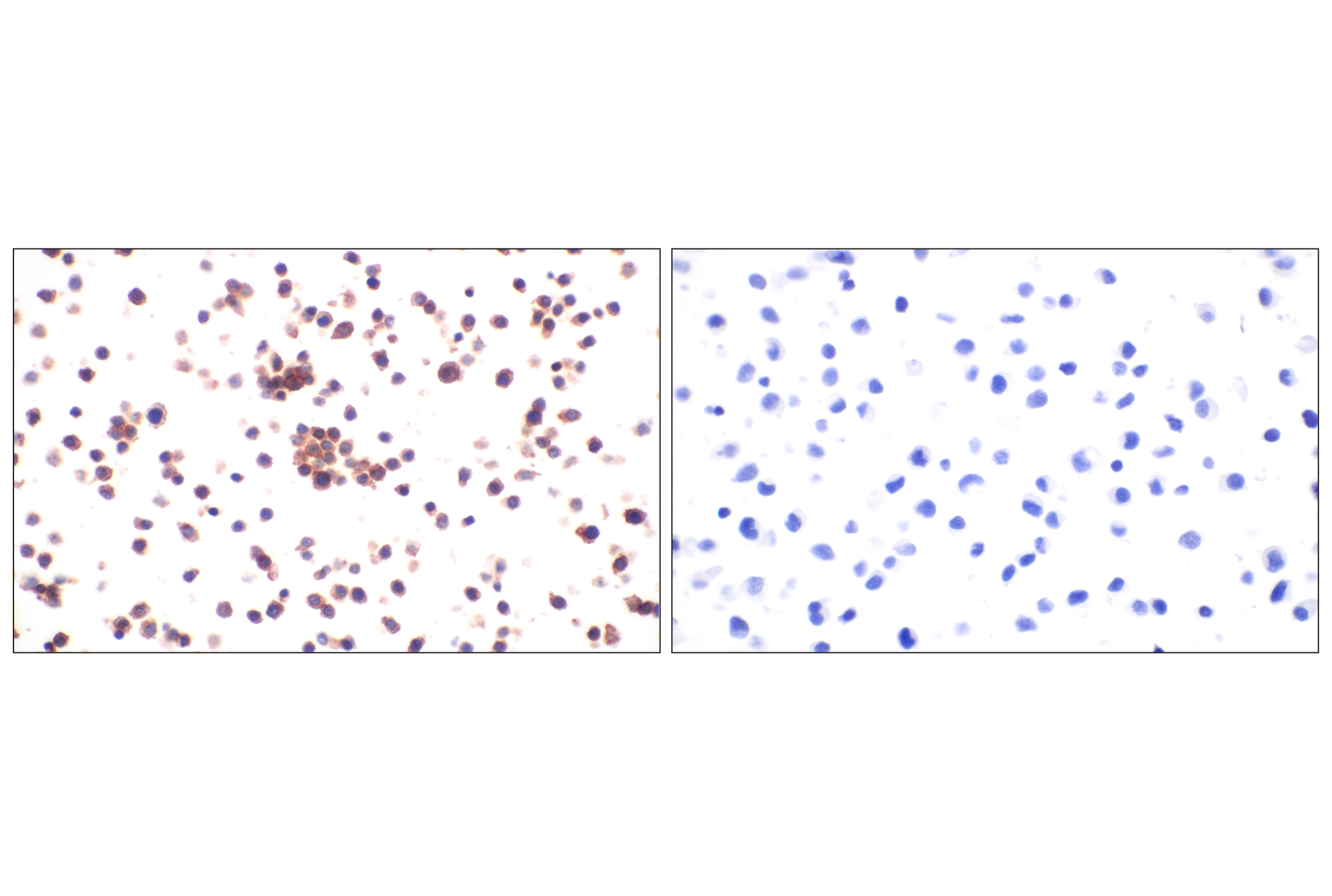 Immunohistochemistry Image 10: DAP12 (F1Q2P) Rabbit mAb