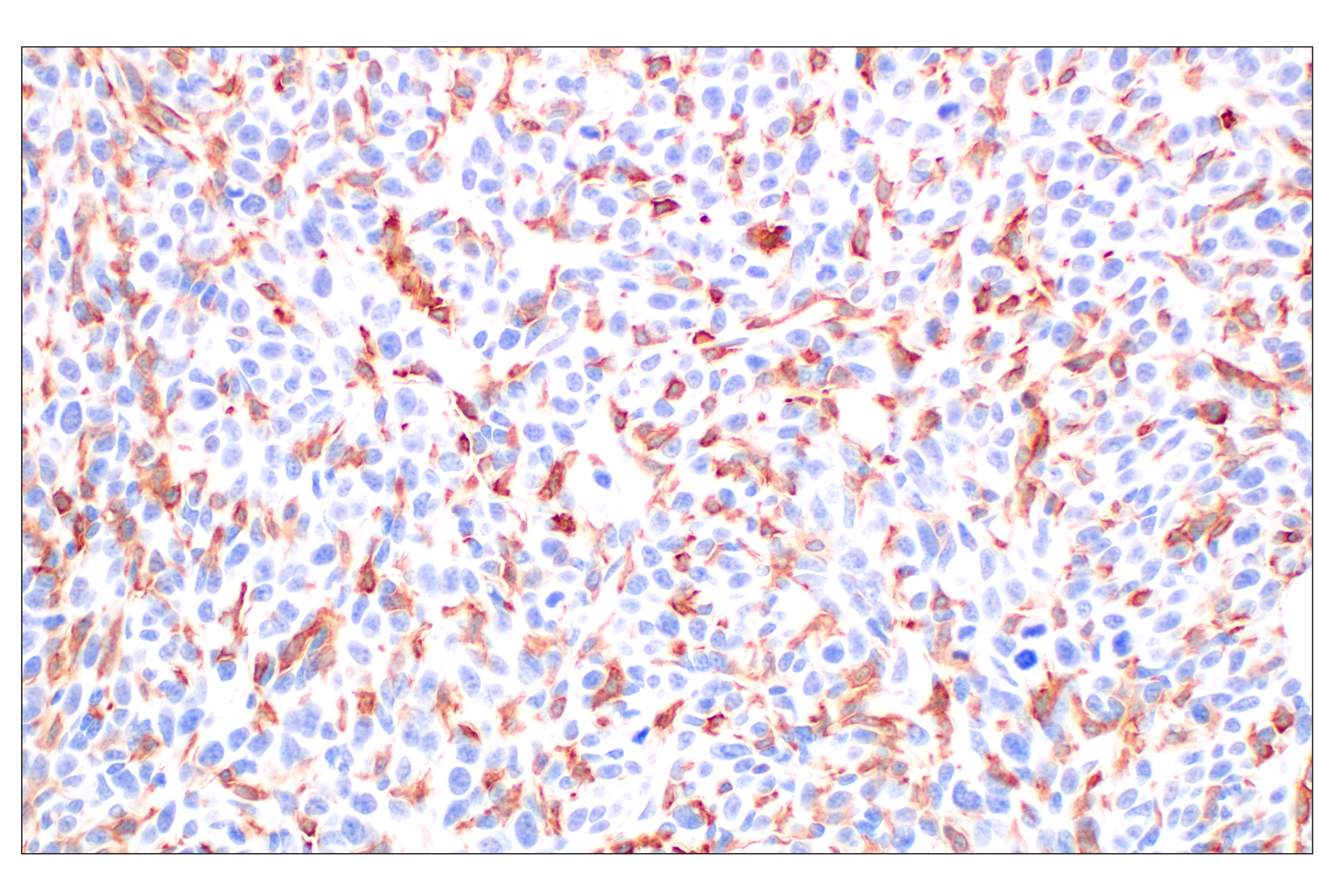 Immunohistochemistry Image 1: DAP12 (F1Q2P) Rabbit mAb