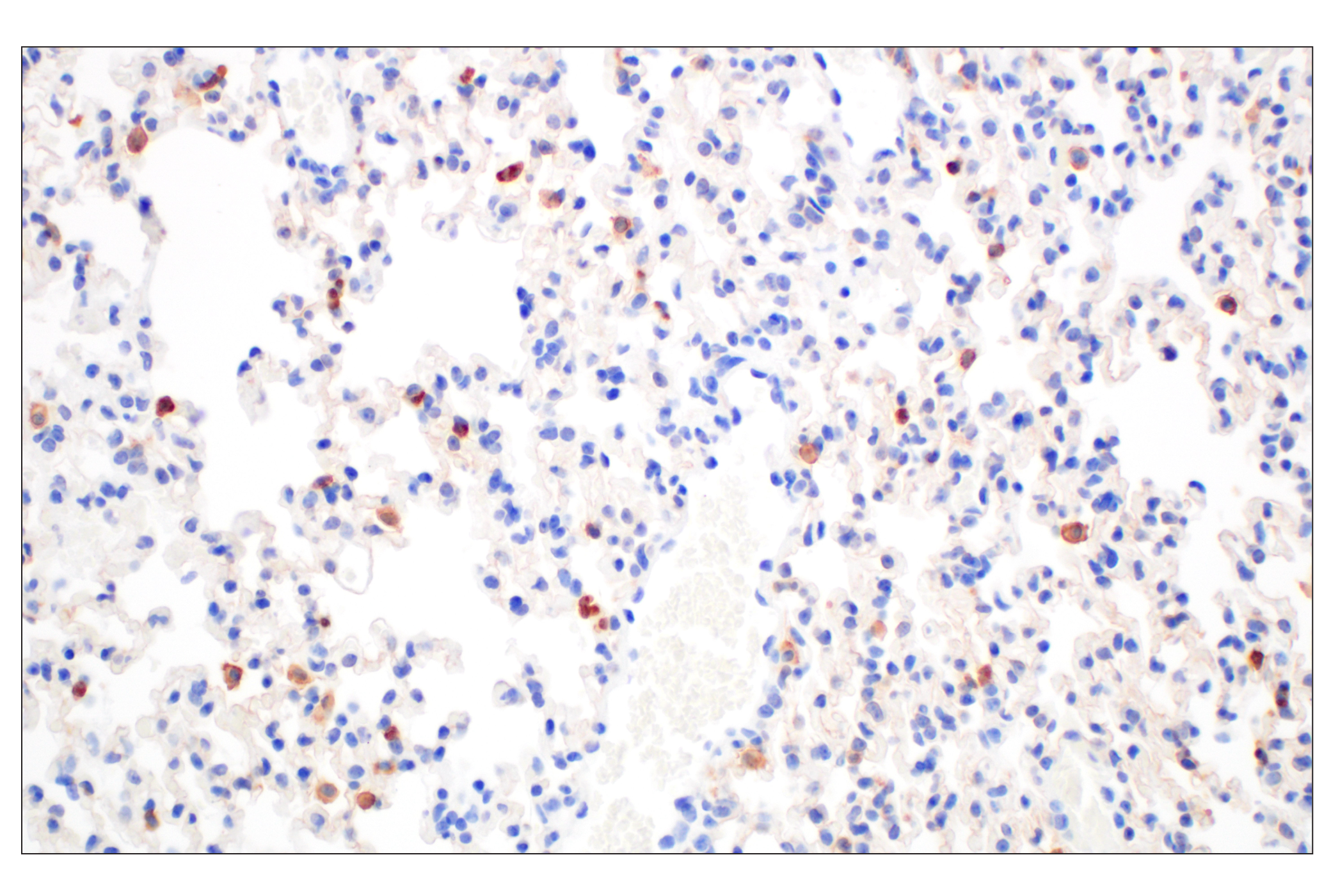 Immunohistochemistry Image 5: DAP12 (F1Q2P) Rabbit mAb