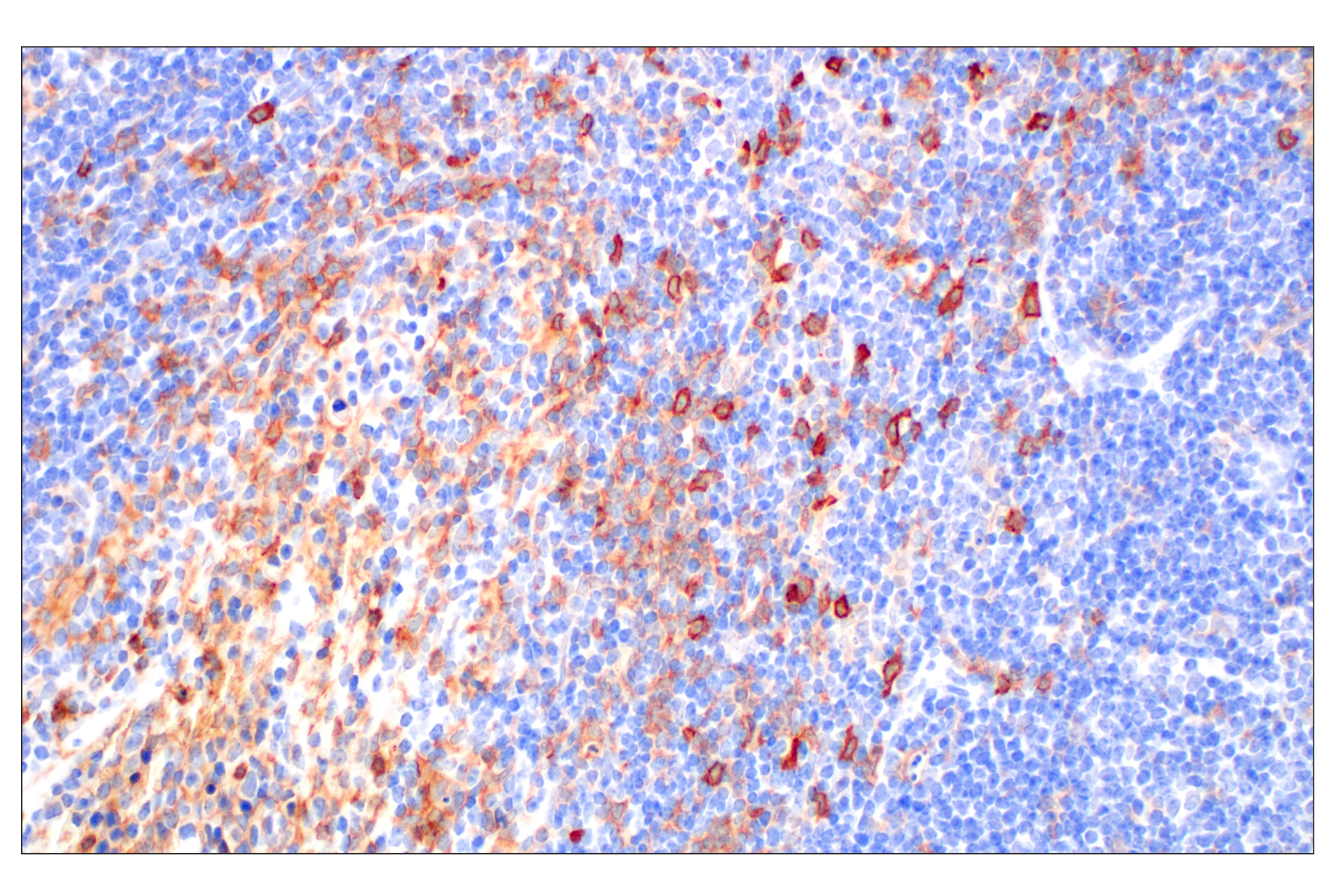 Immunohistochemistry Image 6: DAP12 (F1Q2P) Rabbit mAb