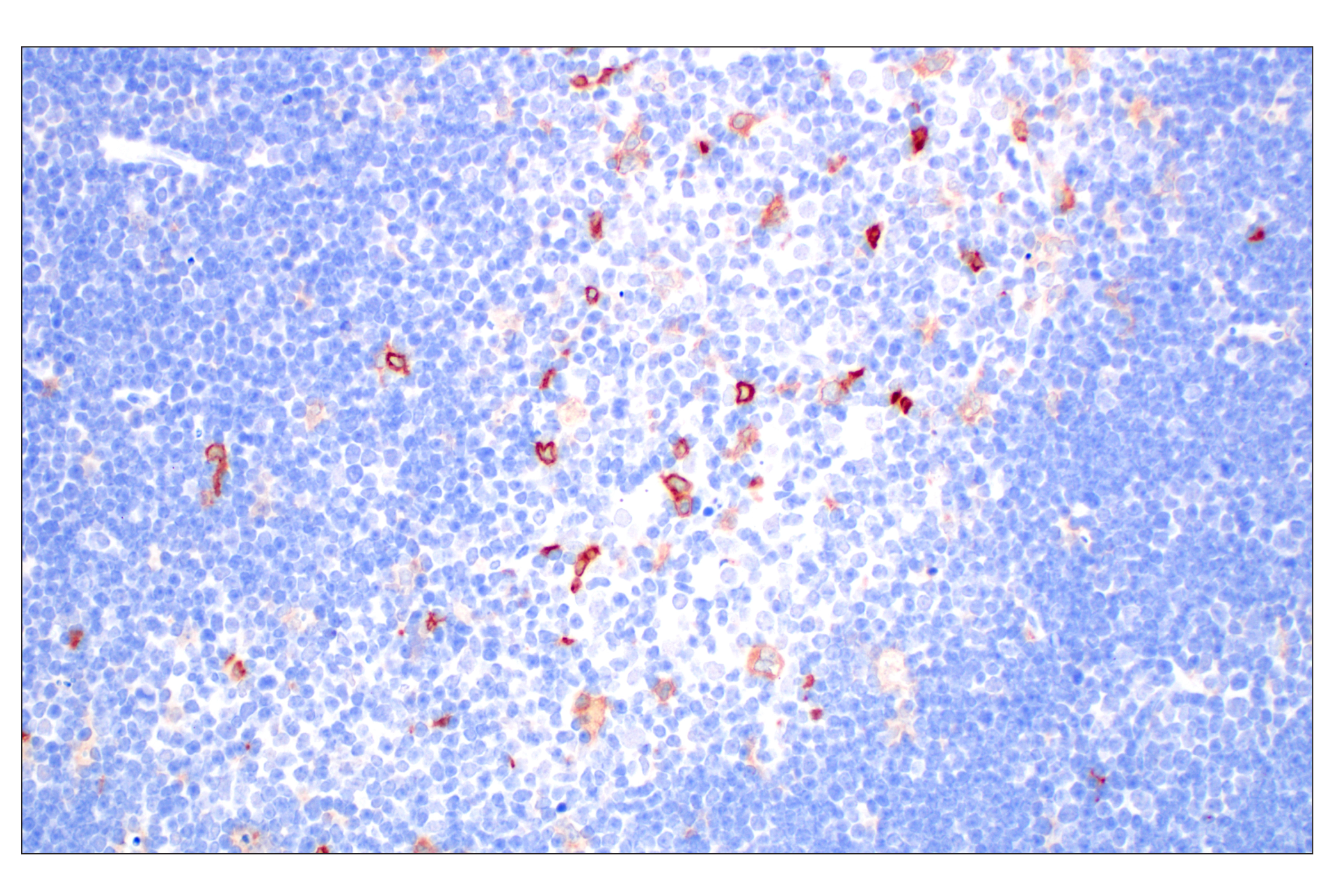 Immunohistochemistry Image 4: DAP12 (F1Q2P) Rabbit mAb