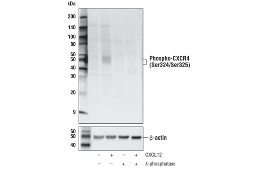 Western Blotting Image 2: Phospho-CXCR4 (Ser324/Ser325) Antibody