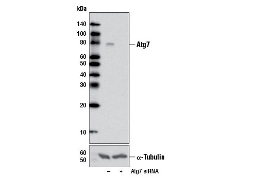  Image 9: Autophagy Vesicle Elongation (Atg12 Conjugation) Antibody Sampler Kit
