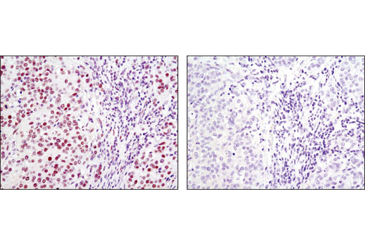 Immunohistochemistry Image 1: FoxP1 (D35D10) XP® Rabbit mAb (BSA and Azide Free)
