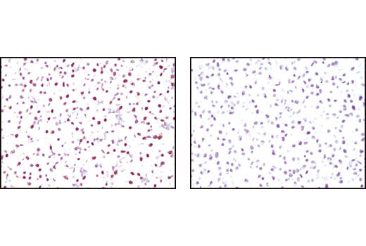 Immunohistochemistry Image 1: Oct-4A (C52G3) Rabbit mAb (BSA and Azide Free)