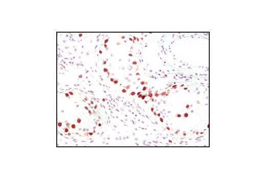 Immunohistochemistry Image 2: Oct-4A (C52G3) Rabbit mAb (BSA and Azide Free)