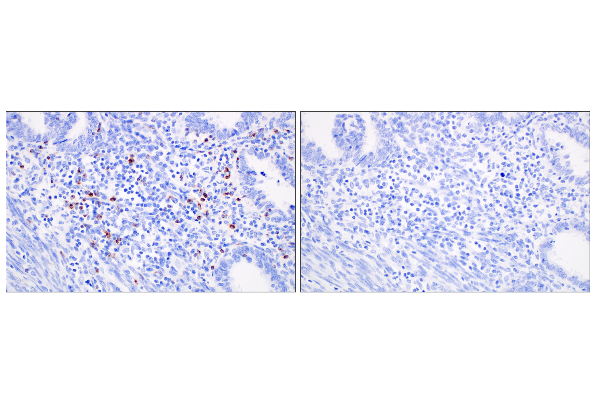 Immunohistochemistry Image 6: CXCL13 (F6A4R) Rabbit mAb