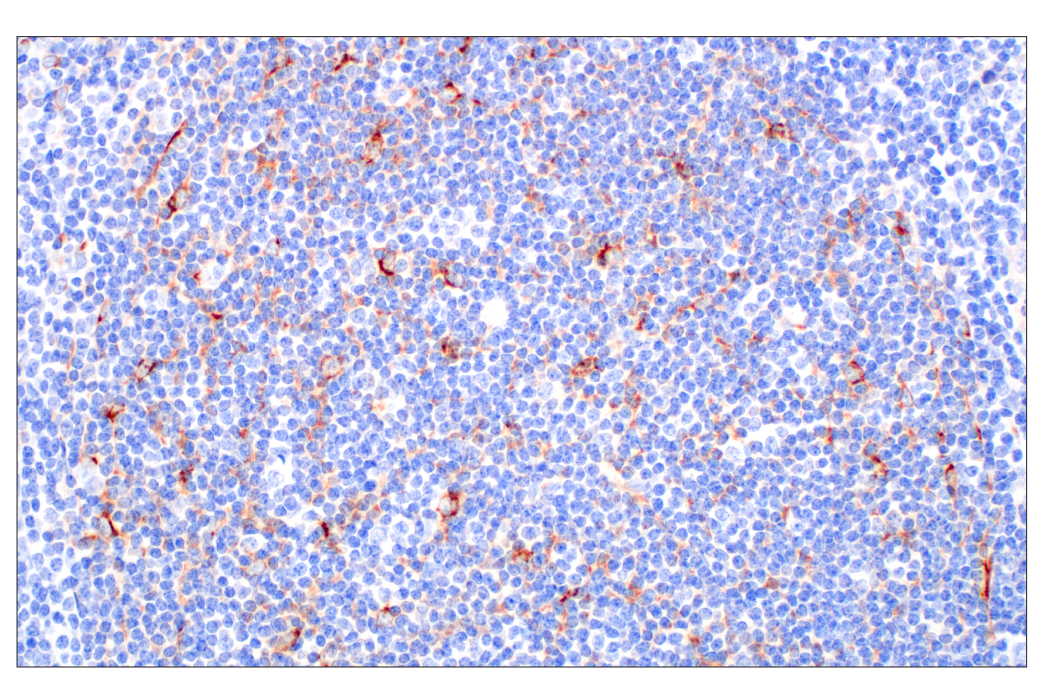 Immunohistochemistry Image 4: CXCL13 (F6A4R) Rabbit mAb