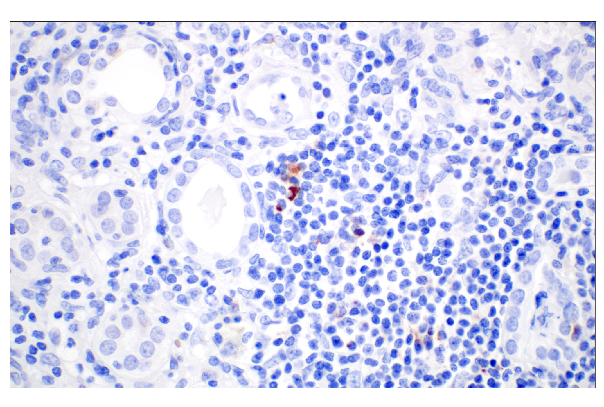 Immunohistochemistry Image 3: CXCL13 (F6A4R) Rabbit mAb