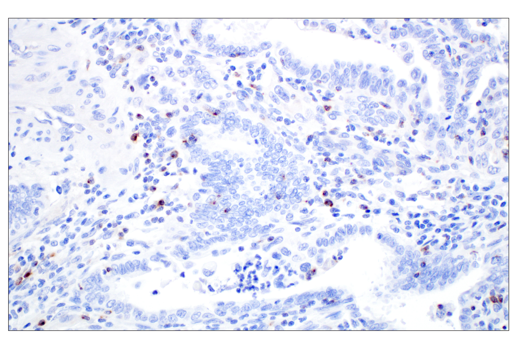Immunohistochemistry Image 2: CXCL13 (F6A4R) Rabbit mAb