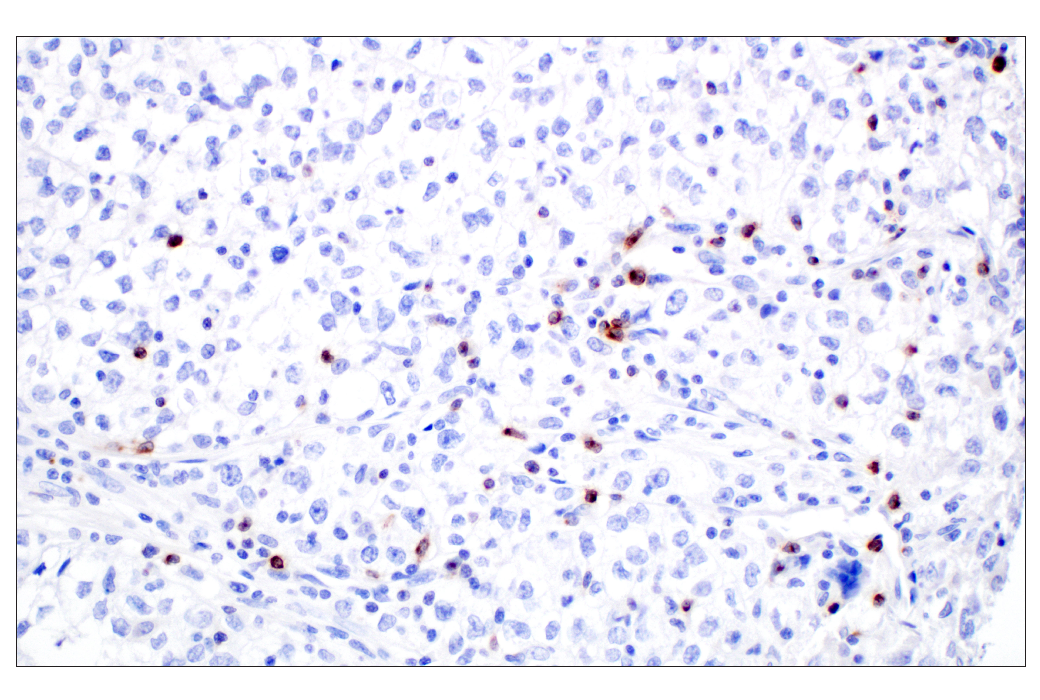 Immunohistochemistry Image 1: CXCL13 (F6A4R) Rabbit mAb