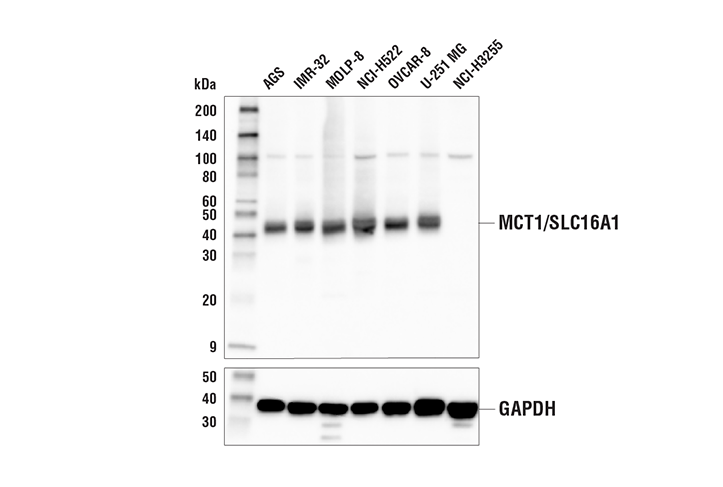 Western Blotting Image 1: MCT1/SLC16A1 Antibody