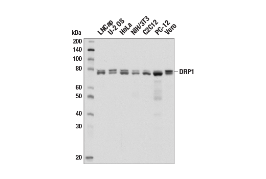  Image 10: Mitochondrial Dynamics Antibody Sampler Kit II