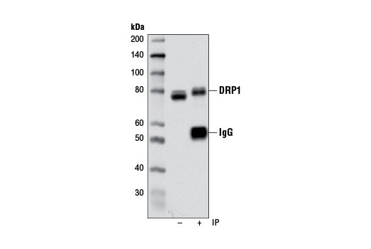  Image 17: Mitochondrial Dynamics Antibody Sampler Kit II