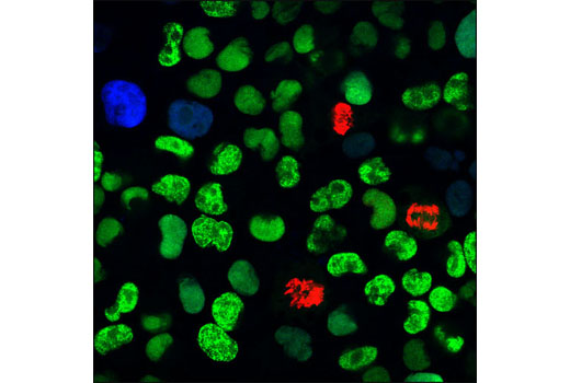 Immunofluorescence Image 1: PCNA (PC10) Mouse mAb (Alexa Fluor® 488 Conjugate)
