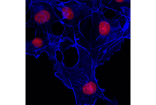 Immunofluorescence Image 1: β-Actin (13E5) Rabbit mAb (Alexa Fluor®647 Conjugate)