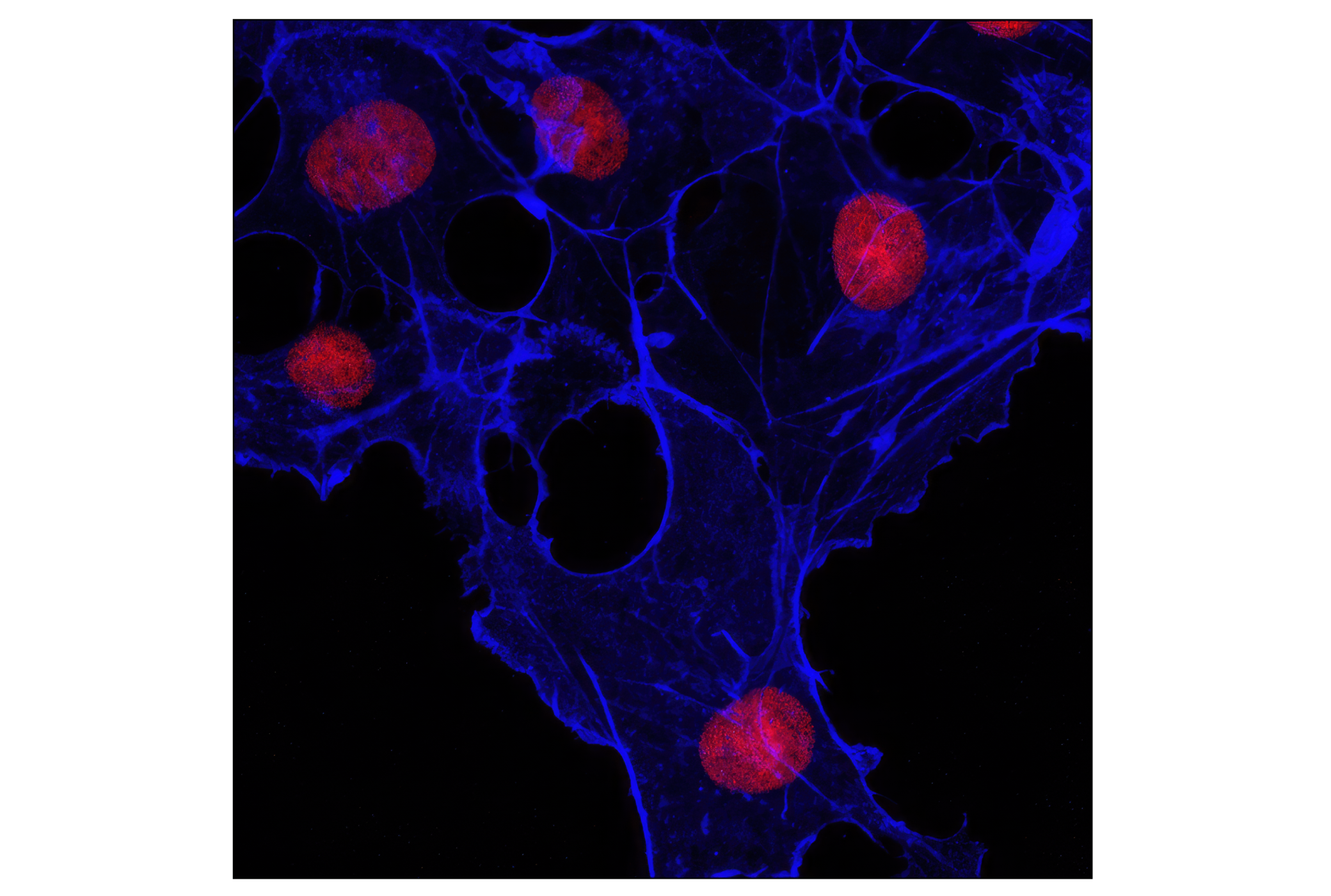 Immunofluorescence Image 1: β-Actin (13E5) Rabbit mAb (Alexa Fluor® 647 Conjugate)