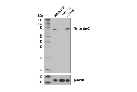 Western Blotting Image 1: Synapsin-2 (D6S9C) Rabbit mAb