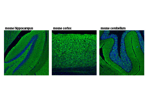 Immunofluorescence Image 1: Synapsin-2 (D6S9C) Rabbit mAb