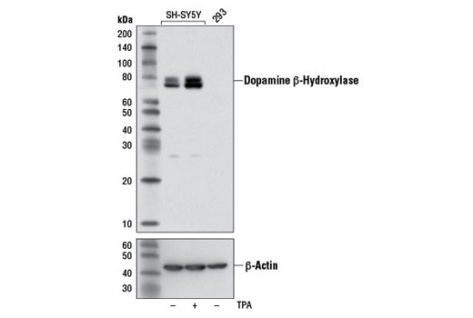 Western Blotting Image 1: Dopamine β-Hydroxylase (DBH) Antibody