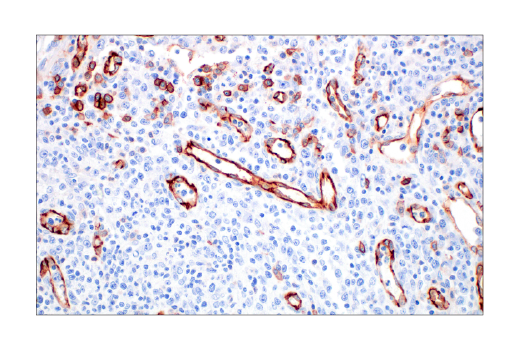 Immunohistochemistry Image 4: CD31 (PECAM-1) (89C2) Mouse mAb (BSA and Azide Free)