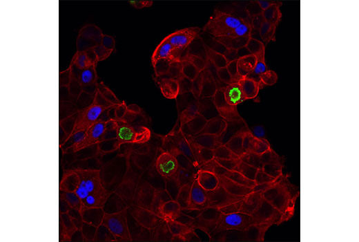 Immunofluorescence Image 1: p21 Waf1/Cip1 (12D1) Rabbit mAb (Alexa Fluor® 647 Conjugate)
