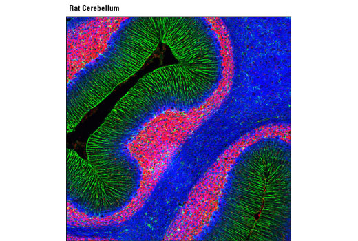 Immunofluorescence Image 1: Neurofilament-L (C28E10) Rabbit mAb (Alexa Fluor® 647 Conjugate)