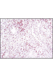Immunohistochemistry Image 2: TCF1/TCF7 (C63D9) Rabbit mAb (BSA and Azide Free)