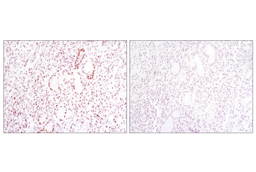 Immunohistochemistry Image 3: TCF1/TCF7 (C63D9) Rabbit mAb (BSA and Azide Free)