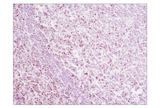 Immunohistochemistry Image 1: TCF1/TCF7 (C63D9) Rabbit mAb (BSA and Azide Free)