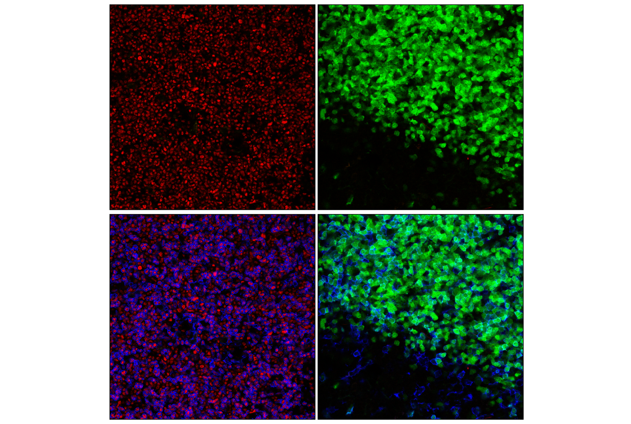 Immunofluorescence Image 1: TCF1/TCF7 (C63D9) Rabbit mAb (BSA and Azide Free)