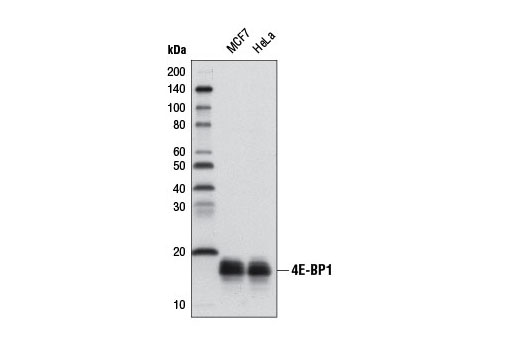 Western Blotting Image 1: 4E-BP1 (53H11) Rabbit mAb (Biotinylated)