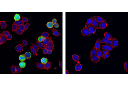 Immunofluorescence Image 1: Phospho-Stathmin (Ser38) (D19H10) Rabbit mAb (BSA and Azide Free)