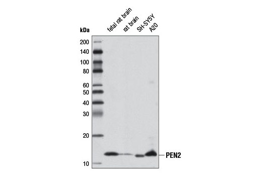  Image 4: γ Secretase Antibody Sampler Kit