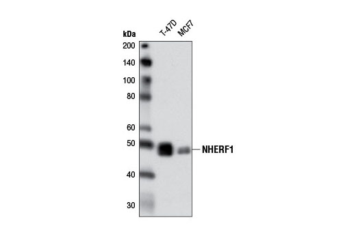 Western Blotting Image 1: NHERF1 (D1C10) Rabbit mAb