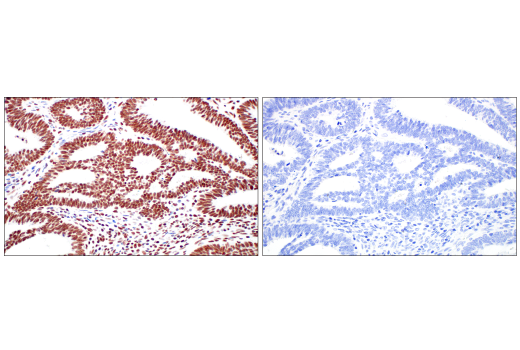 Immunohistochemistry Image 11: METTL3 (E3F2A) Rabbit mAb