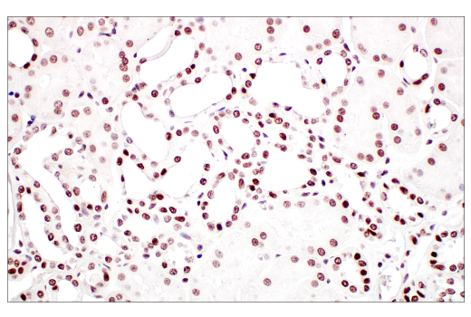Immunohistochemistry Image 5: METTL3 (E3F2A) Rabbit mAb