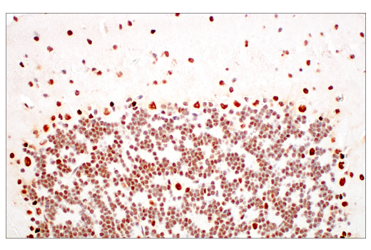 Immunohistochemistry Image 8: METTL3 (E3F2A) Rabbit mAb