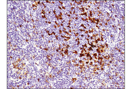  Image 49: Human Exhausted CD8+ T Cell IHC Antibody Sampler Kit