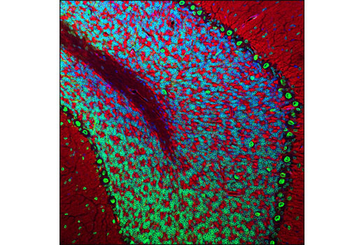 Immunofluorescence Image 1: Lamin A/C (4C11) Mouse mAb (Alexa Fluor® 488 Conjugate)