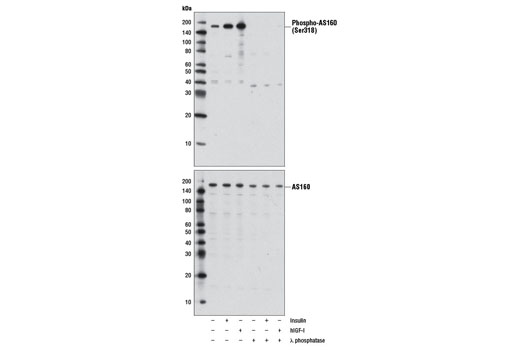  Image 8: AS160 Signaling Antibody Sampler Kit